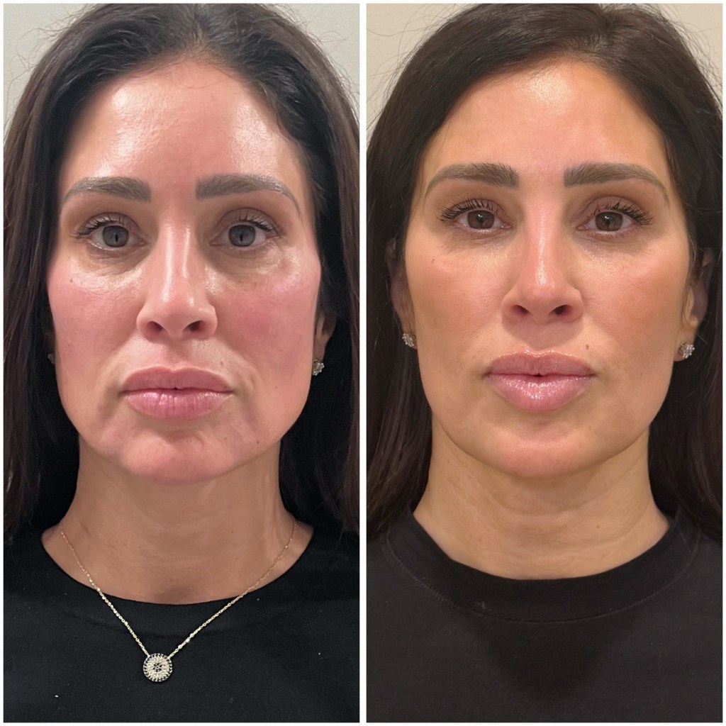 Recent client result