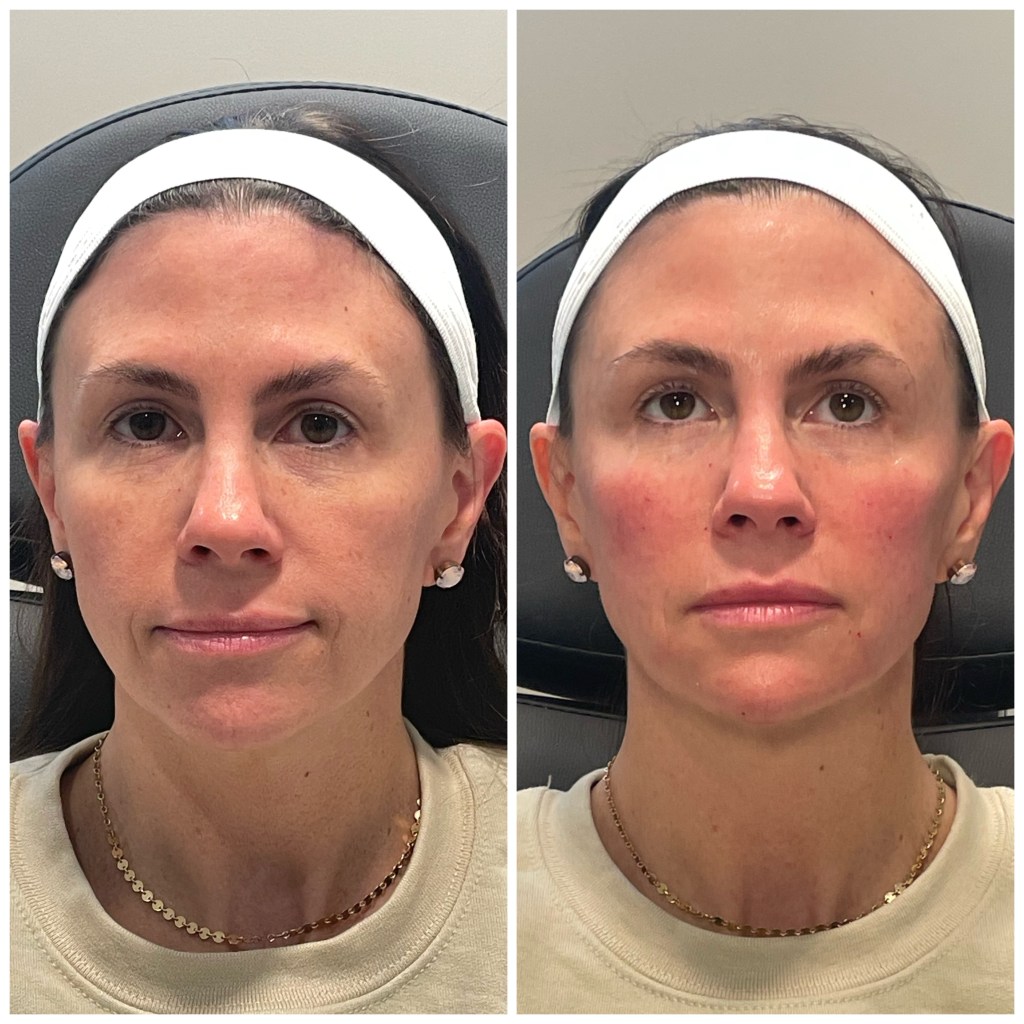 Recent client result